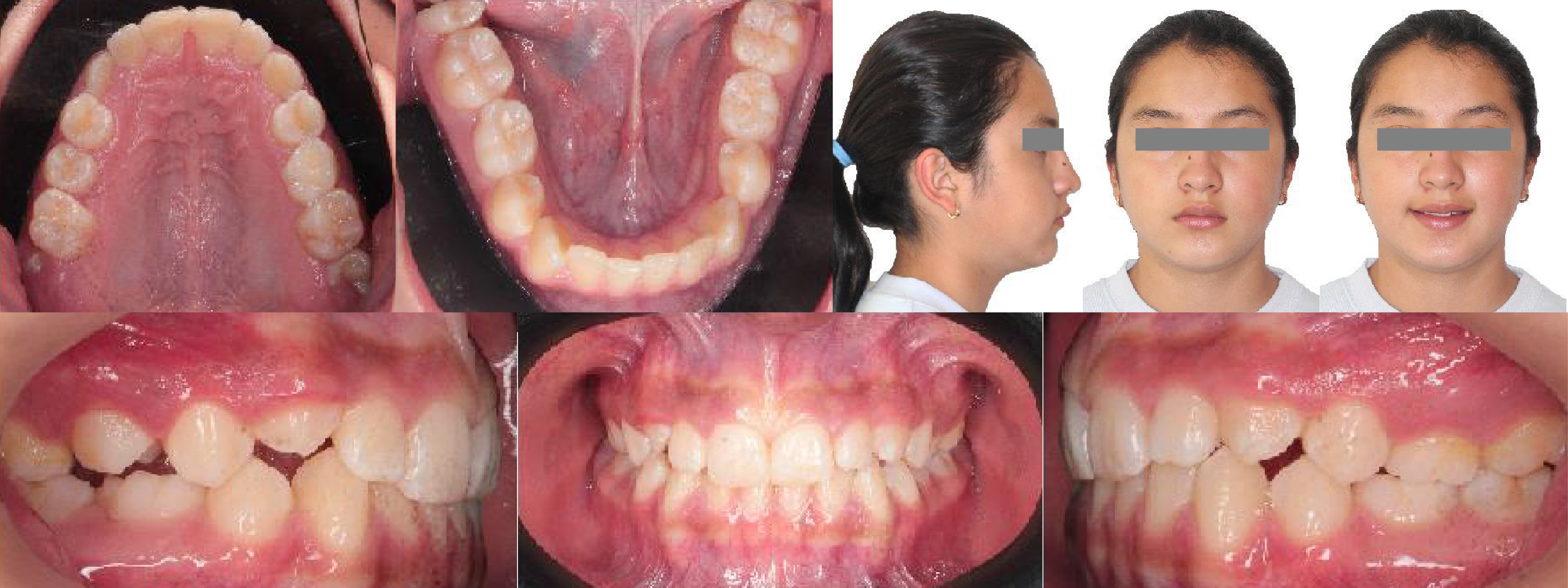 Radiografía Intrabucal